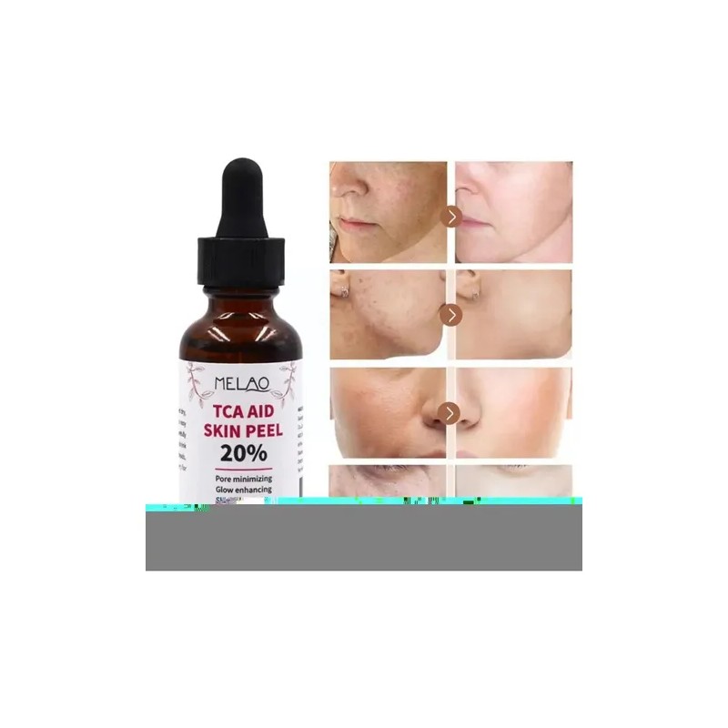 . 30 Ml De Tca Aid Exfoliante Para La Piel,