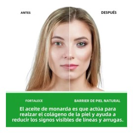 Aceite Natural De Monarda Para Piel, Cabello Y Aromaterapia