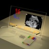 Sonogram Picture Frame, Acrylic Ultrasound Picture Frame with Light and