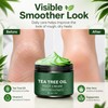 Tea Tree Oil Foot Cream for Dry Cracked Skin, Intensive