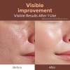 ID Placosmetics [ID Placosmetics]Exo-V Booster Ampoule 30ml