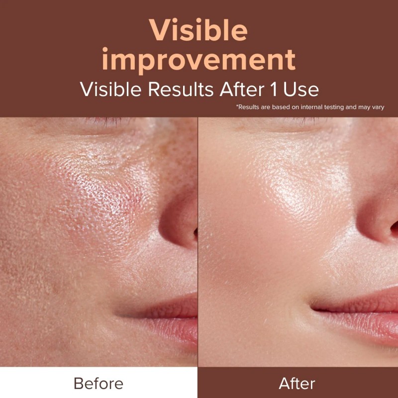 ID Placosmetics [ID Placosmetics]Exo-V Booster Ampoule 30ml