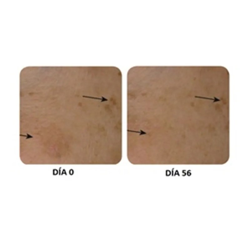 Crema Despigmentante Acido Kojico, Glicolico Y Vitamina C