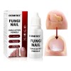 15ml Líquido Para Hongos En Las Uñas-mata Los Hongos En
