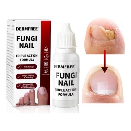 15ml Líquido Para Hongos En Las Uñas-mata Los Hongos En Las