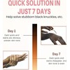 Dark Knuckle Whitening Serum, Whitening Serum Hand Knuckle Glow Serum