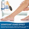 UOY Hydrating and Anti-Cracking Foot Cream, Foot Care Cream with