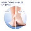 Sch oll Foot Cream for Cracked Heels with Urea and