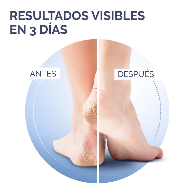Sch oll Foot Cream for Cracked Heels with Urea and
