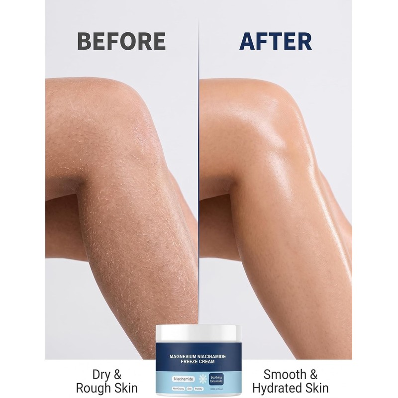 Magnesium Niacinamide Freeze Cream, 120g Non Greasy Cooling Body Skin