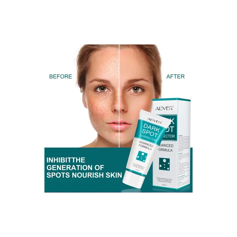 Crema Aclarante Elimina Manchas Piel Exfoliante Facial A