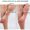 Hey Honey WALK THE WALK Foot & Heel Repair -