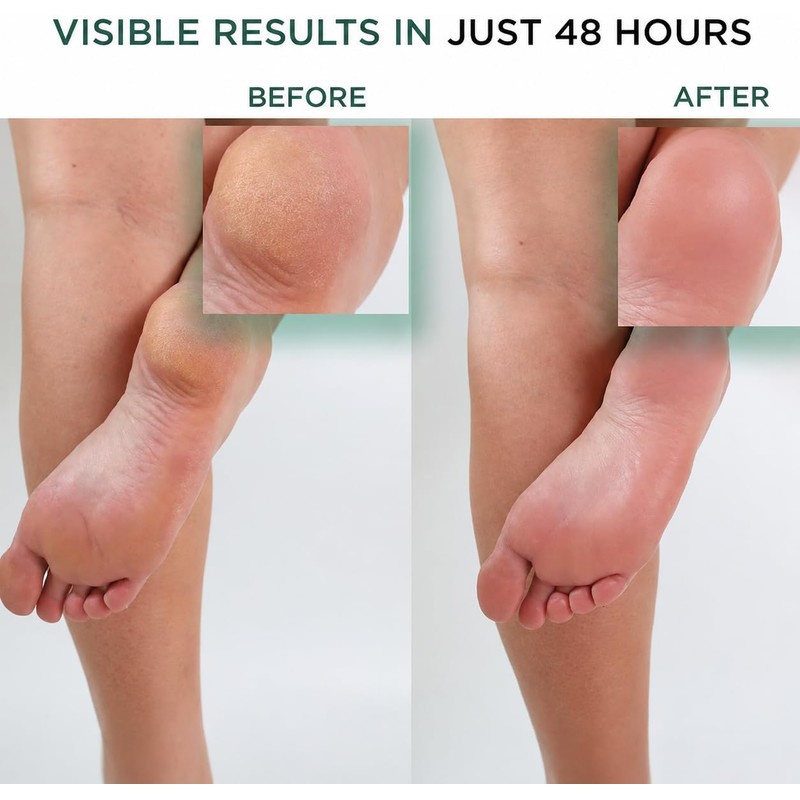 Hey Honey WALK THE WALK Foot & Heel Repair -