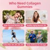 Babivek 2 Pack Collagen Gummies for Women & Men –