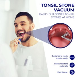 Oravix Tonsil Stone Vacuum, Tonsil Stone Remover Vacuum Suction, Tonsil Stone Cupping Tool, Tonsil Stone Removal Tool with Suction, Tonsil Stones Removal Vacuum, Tonsil Stone Extractor - 3 in 1 Kit