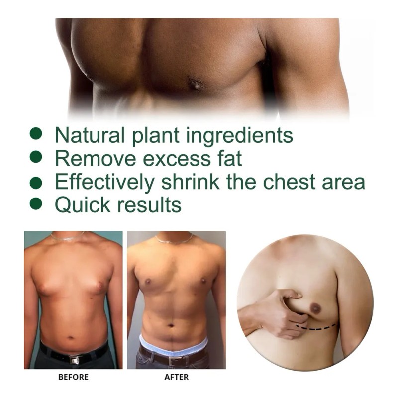 4×la Ginecomastia Acelera El Metabolismo,crema Reafirmante