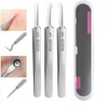 4pcs Blackhead Remover Tweezers Pimple Popper Tool Kit, Extractor Acne
