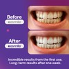 Esmile Purple Power Teeth Whitening Strips, Vegan and Cruelty Free,
