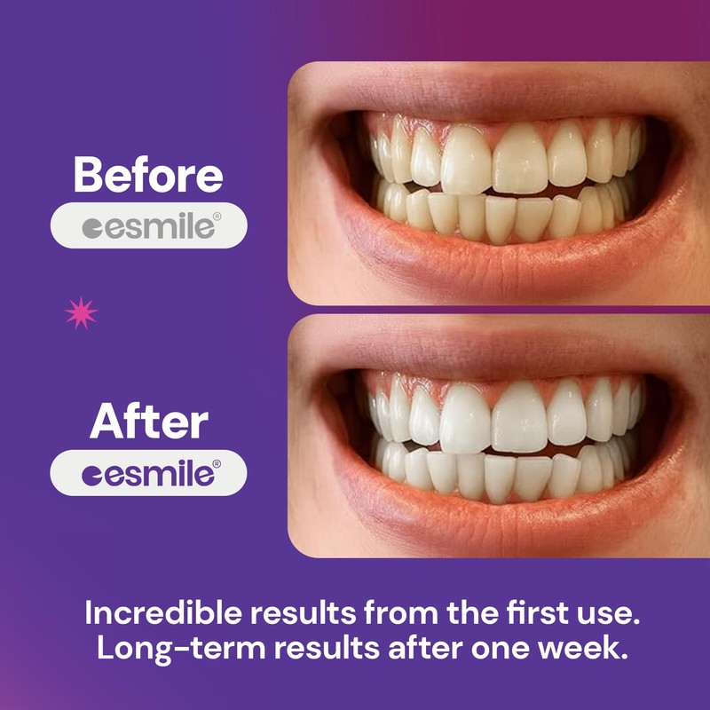 Esmile Purple Power Teeth Whitening Strips, Vegan and Cruelty Free,