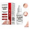 Solución Antifúngica Para Uñas, Pies Y Manos 15 Ml Blanco