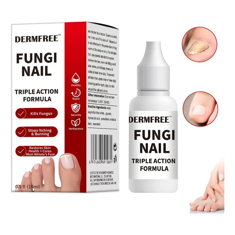 Solución Antifúngica Para Uñas, Pies Y Manos 15 Ml Blanco