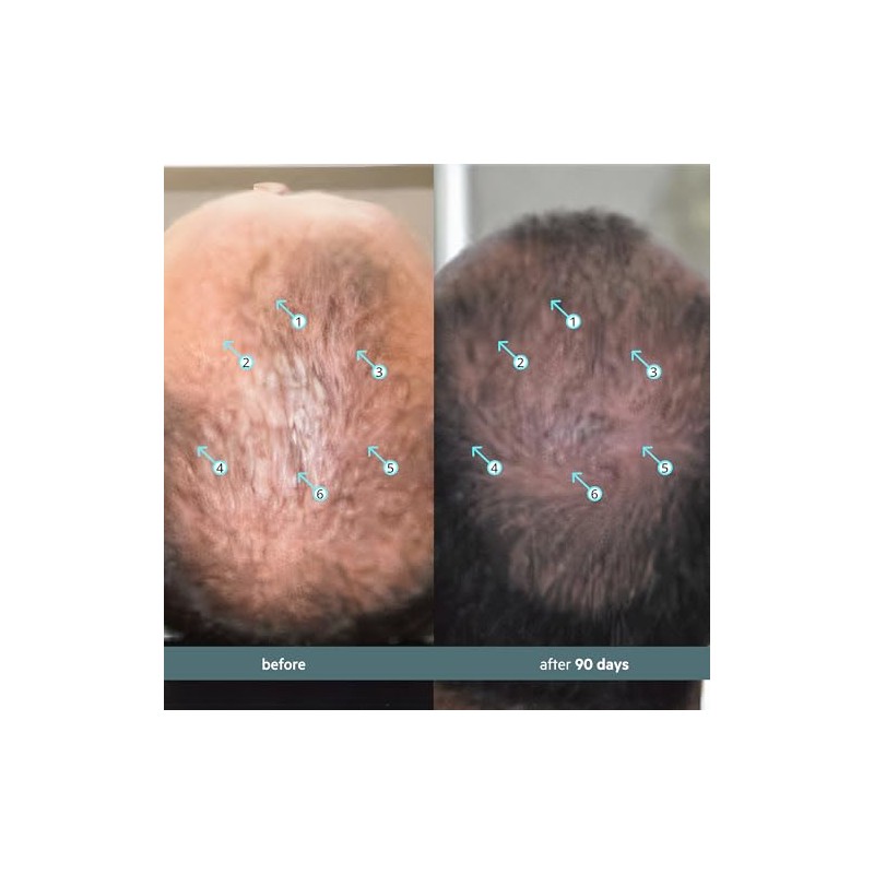 Ds Laboratories | Spectral® F7 Tratamiento Capilar con Ingredientes que