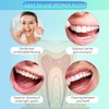 Easy-to-Use Sponge Floss for Cleaning of Implants Bridges with Stiff
