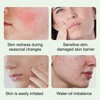 Centella Asiatica Serum,Facial Soothing Redness Serum|For Sensitive Skin-Including Chamomile Extract,