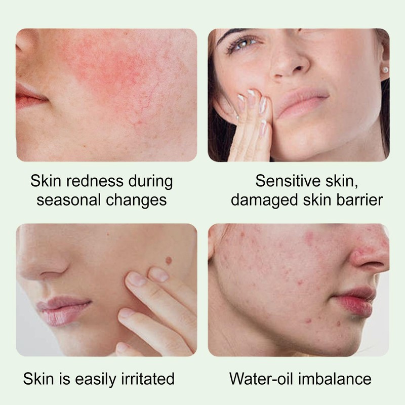 Centella Asiatica Serum,Facial Soothing Redness Serum|For Sensitive Skin-Including Chamomile Extract,