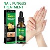 M Jaysuing Tratamiento Hongos De Uñas Herbal 30ml Neutra