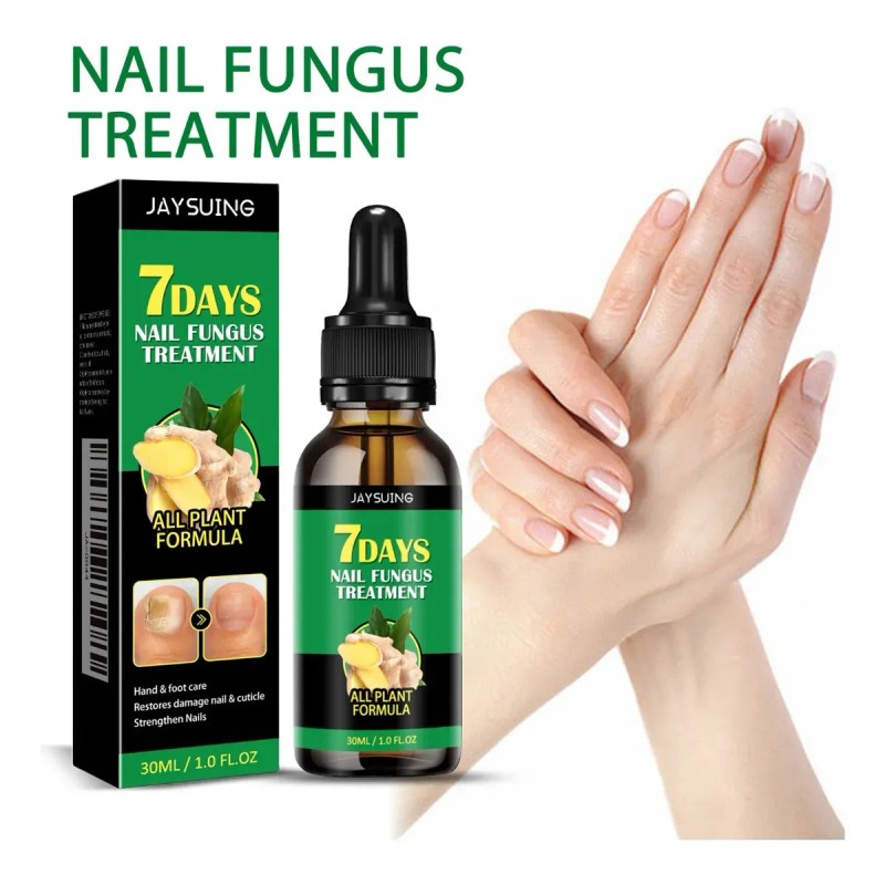 M Jaysuing Tratamiento Hongos De Uñas Herbal 30ml Neutra