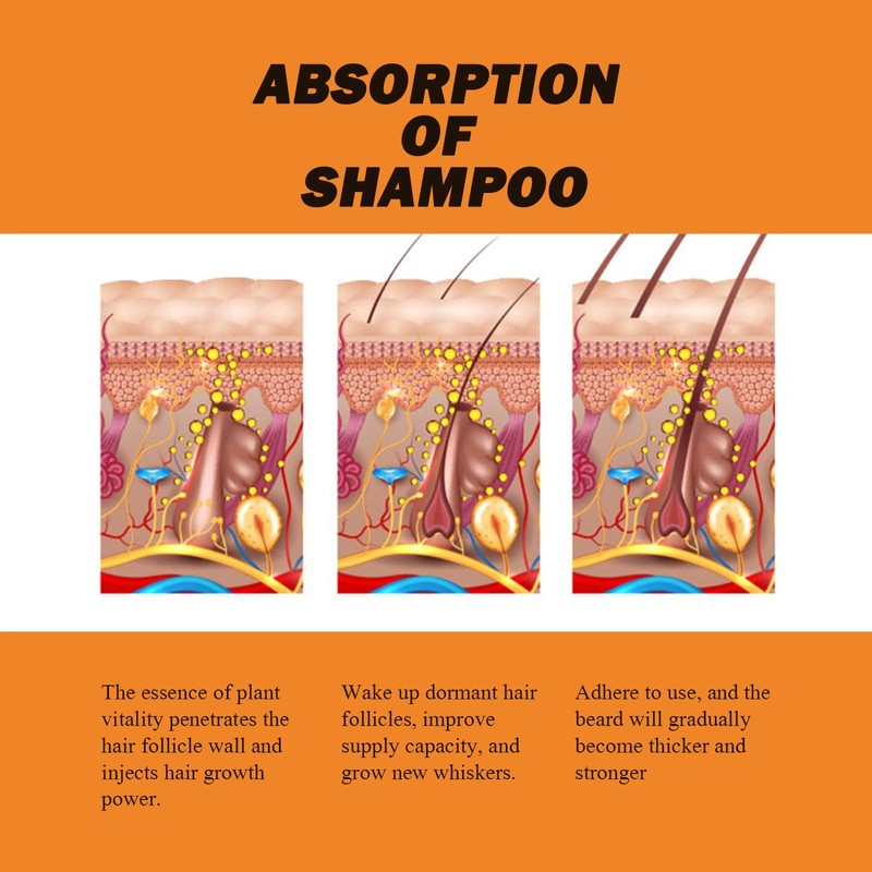Rostblant Bart Verdunkelung Shampoo,Natural Hair Dye, Instant Hair Shampoo Haarfarbe,