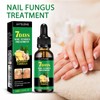 JAYSUING Ginger Nail Care Solution Repair Hand and Foot Nail