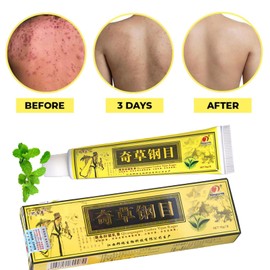 Chinese Body Care Set 3PCS East Asian Skin Care Cream for Neck Hand Body,Soothing Plant Essence Formula for Dry Red Skin Relief and Hydration Balance