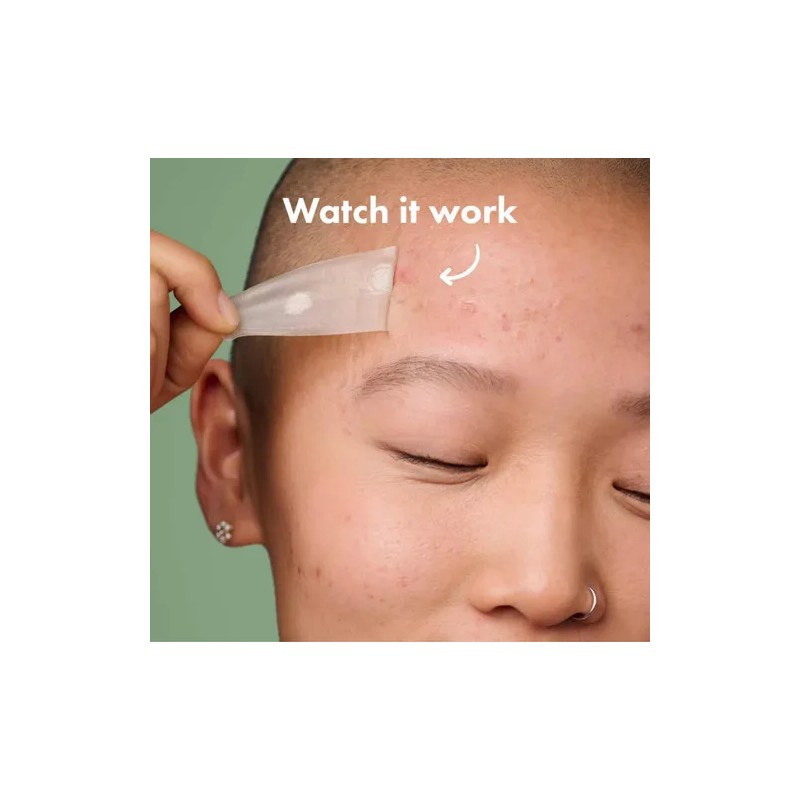 Parche para Acné Mighty Patch Surface XL 10 Piezas Hero