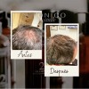 Tónico Vittale Anticaída Crecimiento Restaura Cabello Paso 1
