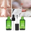 Face Nose Pores Shrinking Repairing Smoothing Blackhead Removal Liquid Essential