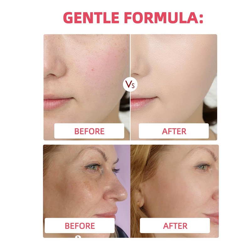 Collagen Jelly Cream -Collagen Face Cream for Deep Hydration, Skin