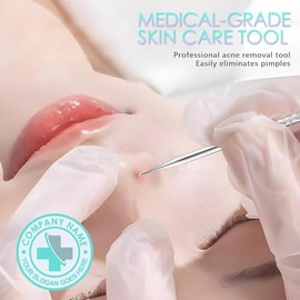 Kit de herramientas de eliminación de puntos negros de grado médico, herramienta de extracción de puntos negros, pinzas de puntos negros, kit de eliminación de etiquetas de piel para eliminar manchas