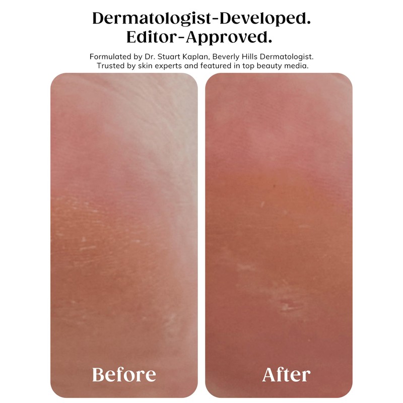 KAPLAN MD Diamond Contour Insta-Glow Gommage Body Peel – Body