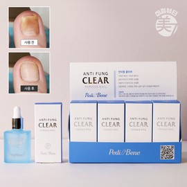 Pedibene Buzel Pedibene Antipung Clear 10ml 8 pcs 1 box / 뷰젤 페디베네 안티펑 클리어 10ml 8개 1box
