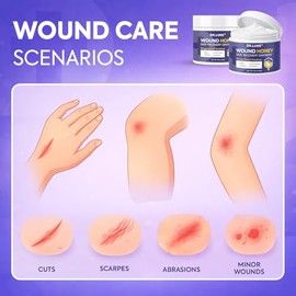 Dr. Luke Manuka Honey Wound Care: Wound Gel for Minor Wounds & Skin Repair - Manuka Honey Medical Grade with Allantoin 0.5% & Vitamin E - 2.82 oz (80g)