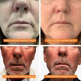 The [pH]ix Philler Peptide Serum - daily skincare for fine lines, wrinkles and skin renewal