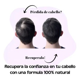 Fortipelo Kit Anticaída Shampoo Con Papa Romero Sábila Chile