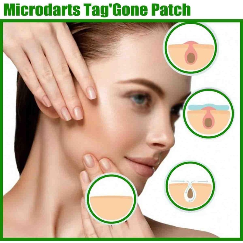 Microdarts Tag'gone Nano Patch,Natural Skin and Face Care Patch，2pc