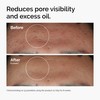 The Ordinary Niacinamide 10% + Zinc 1%, Smoothing Serum for