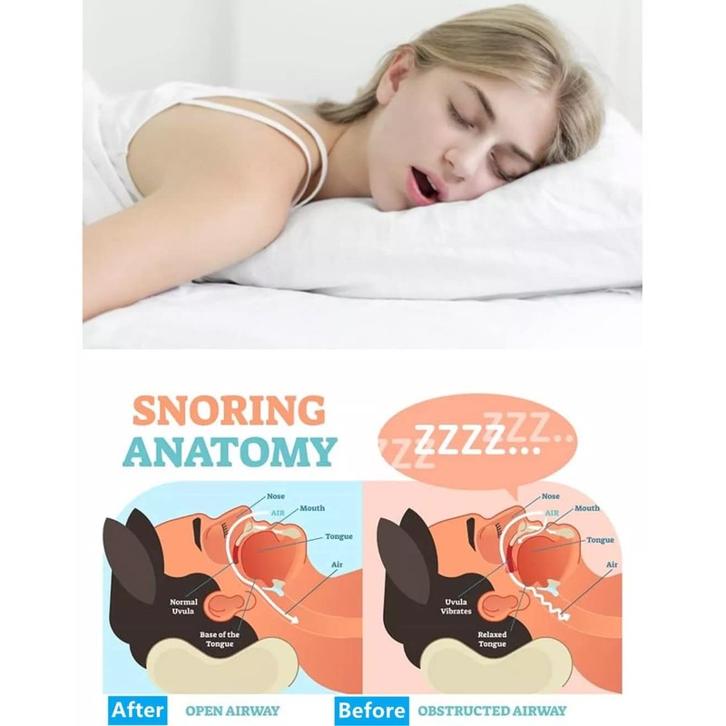6 pc Anti Snore Devices, Magnetic Anti Snore Clip Reusable