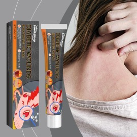 South Moon Scar Care Cream Gentle Nourishing Body Moisturizer with Soothing Effects Skin Care CreamSize: 20g
