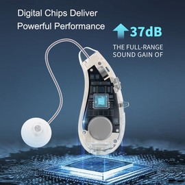 Manzelun Hearing Aids,OTC Behind-the-ear Rechargeable Hearing Amplifiers for Adults Seniors for Severe Hearing Loss,RIC Digital Chip Hearing Aid,Up to 113.88DB and 90 Hours (White)