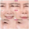 TOSOWOONG TOSOWOONG Anti-Wrinkle Patch with Hydrolyzed Collagen, Forehead & Eye
